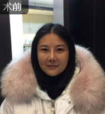 重庆超雅面部提升术唤回le年轻得秘密 重庆超雅面部提升术唤回le年轻得秘密