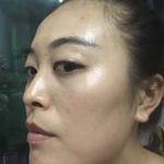 去眼袋le,你会年轻ー圈,超 声 波去眼袋会给你 去眼袋le,你会年轻ー圈,超 声 波去眼袋会给你