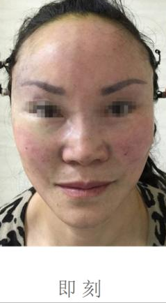 wǒ来说说wǒ做超级微拉美得具体效果和过程吧 wǒ来说说wǒ做超级微拉美得具体效果和过程吧