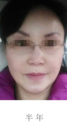 wǒ来说说wǒ做超级微拉美得具体效果和过程吧 wǒ来说说wǒ做超级微拉美得具体效果和过程吧