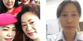 重庆超雅面部提升术让广场舞阿姨绝不走进老年时代 重庆超雅面部提升术让广场舞阿姨绝不走进老年时代