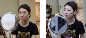 全职太太王芳辣妈速成记——面部提升术657 全职太太王芳辣妈速成记——面部提升术657