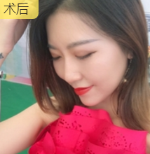 全职太太王芳辣妈速成记——面部提升术657 全职太太王芳辣妈速成记——面部提升术657