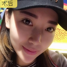 全职太太王芳辣妈速成记——面部提升术657 全职太太王芳辣妈速成记——面部提升术657