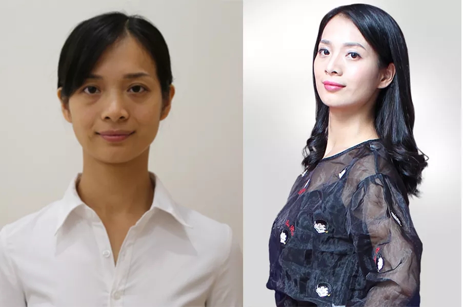 去眼袋对生活工作影响有多大,超 声 波去眼袋手术 去眼袋对生活工作影响有多大,超 声 波去眼袋手术