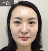超级微拉美受益者祝天美→团购姐蝶变日记889 超级微拉美受益者祝天美→团购姐蝶变日记889