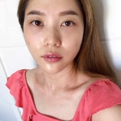 超声波去眼袋之后，感觉就像从来没有长过眼袋似的826
