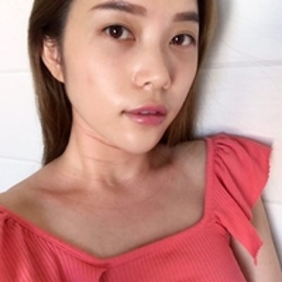 超声波去眼袋之后，感觉就像从来没有长过眼袋似的826