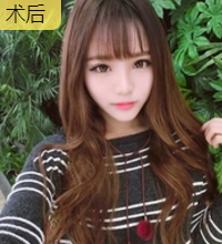 超声波瘦脸让我的演艺之路更上一层楼982 超声波瘦脸让我的演艺之路更上一层楼982