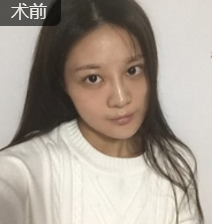 超声波瘦脸让我的演艺之路更上一层楼982 超声波瘦脸让我的演艺之路更上一层楼982