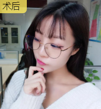 超声波瘦脸让我的演艺之路更上一层楼982 超声波瘦脸让我的演艺之路更上一层楼982