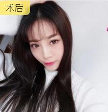 超声波瘦脸让我的演艺之路更上一层楼982 超声波瘦脸让我的演艺之路更上一层楼982