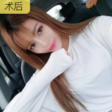 超声波瘦脸让我的演艺之路更上一层楼982 超声波瘦脸让我的演艺之路更上一层楼982
