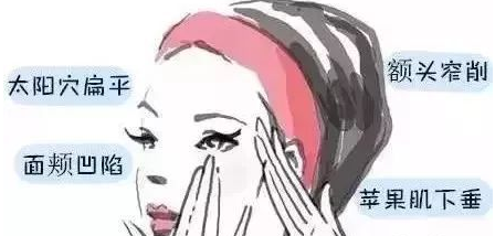 春天来了，自体脂肪填充术把多余的“肥”转化为极致的美！265