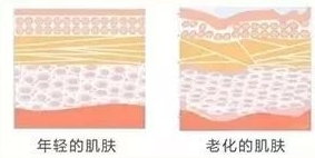 春天来了，自体脂肪填充术把多余的“肥”转化为极致的美！265