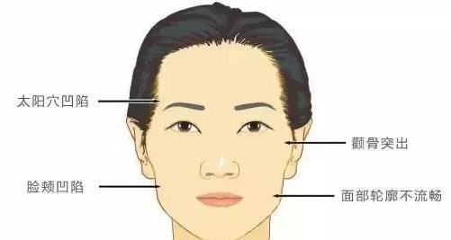 春天来了，自体脂肪填充术把多余的“肥”转化为极致的美！265