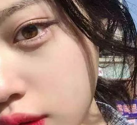 双眼皮手术后，要怎样护理才可达到最佳恢复效果？896