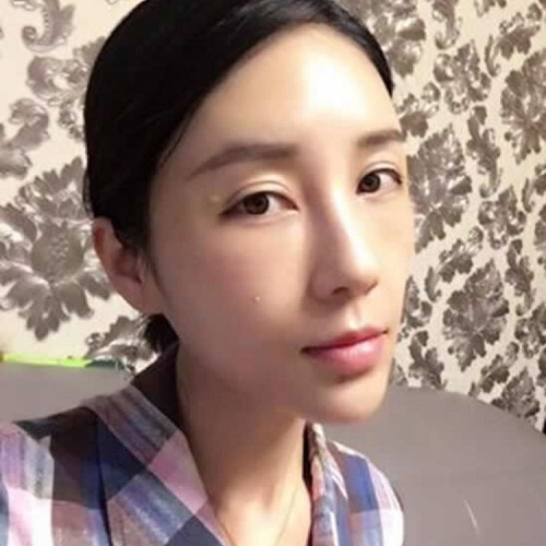 生le孩子眼袋更大,超 声 波去眼袋解决 生le孩子眼袋更大,超 声 波去眼袋解决