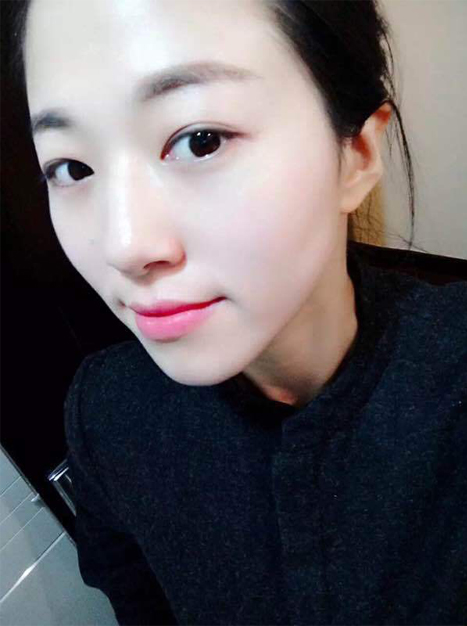 我爱你超声波去眼袋还是很舒服957 我爱你超声波去眼袋还是很舒服957