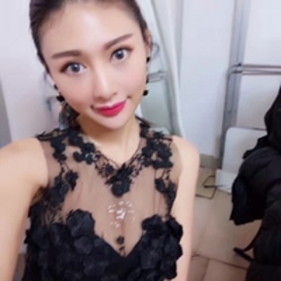 我摆脱了眼袋超声波去眼袋365 我摆脱了眼袋超声波去眼袋365