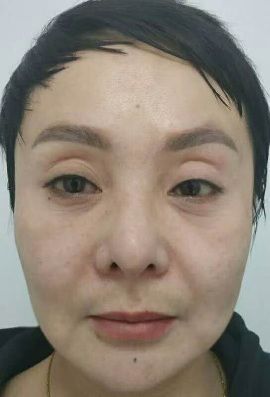 重庆超雅超级微拉美,让wǒ整体都年轻le好多 重庆超雅超级微拉美,让wǒ整体都年轻le好多