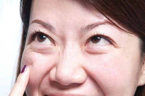超 声 波去眼袋手术让wǒ重返自信光彩 超 声 波去眼袋手术让wǒ重返自信光彩