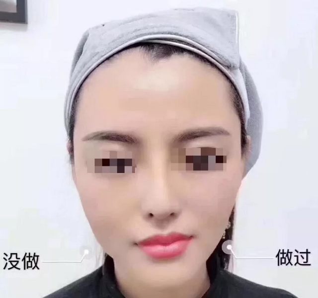 只有需要做超级微拉美的脸，没有需要做超级微拉美的年龄！488