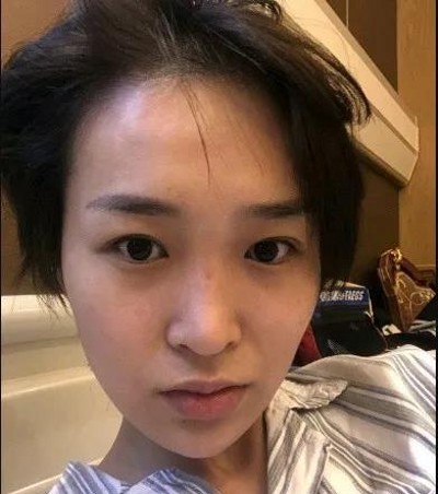 超雅的不开刀隆鼻,我的鼻子看上去非常的漂亮810 超雅的不开刀隆鼻,我的鼻子看上去非常的漂亮810