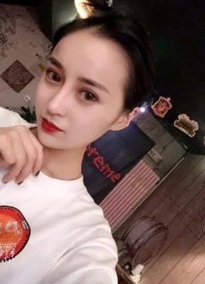 超雅的不开刀隆鼻,我的鼻子看上去非常的漂亮810 超雅的不开刀隆鼻,我的鼻子看上去非常的漂亮810