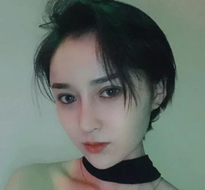 超雅的不开刀隆鼻,我的鼻子看上去非常的漂亮810 超雅的不开刀隆鼻,我的鼻子看上去非常的漂亮810