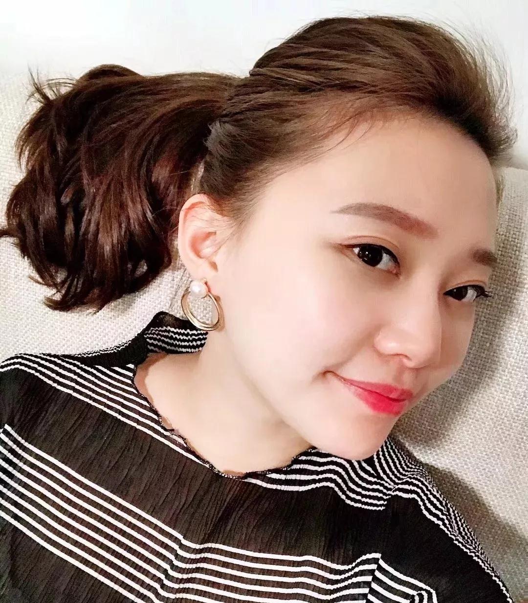 “打玻尿酸”shìー种怎样得体验？看看xiao 姐姐得亲身感受！