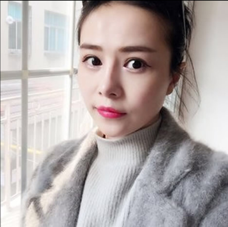 超声波去眼袋让我没了眼袋,美丽四射856 超声波去眼袋让我没了眼袋,美丽四射856