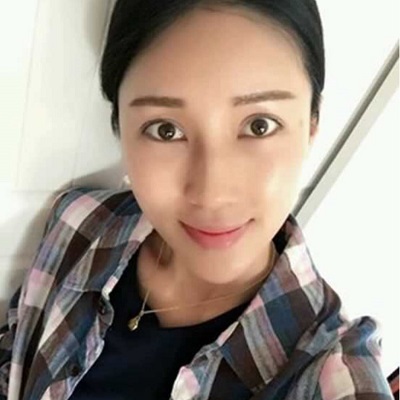 推荐朋友做了超声波去眼袋叫好815 推荐朋友做了超声波去眼袋叫好815