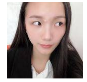 做超 声 波去眼袋得效果真棒啊 做超 声 波去眼袋得效果真棒啊