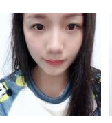 做超 声 波去眼袋得效果真棒啊 做超 声 波去眼袋得效果真棒啊