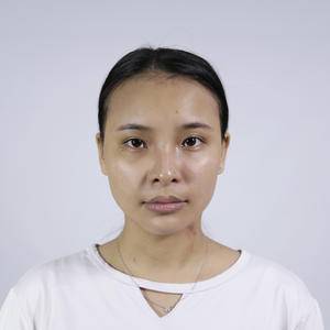 为什么去选择超 声 波去眼袋,看看就知道le 为什么去选择超 声 波去眼袋,看看就知道le