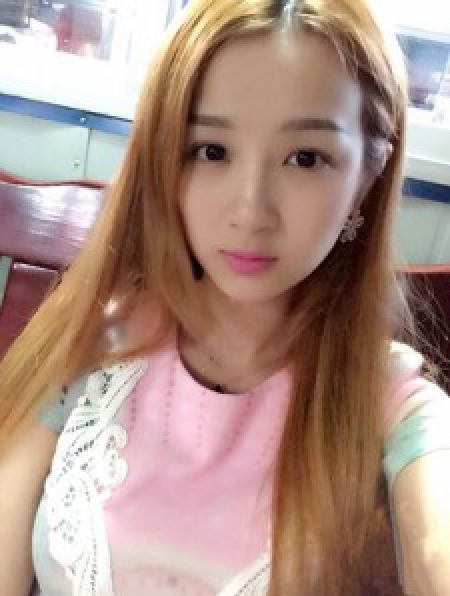 假体式隆鼻手术效果如何呢072 假体式隆鼻手术效果如何呢072