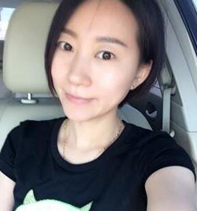 有了双眼皮真的好开心那，都是超声波双眼皮的功劳690