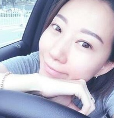 有了双眼皮真的好开心那，都是超声波双眼皮的功劳690