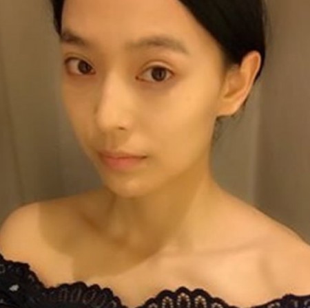 做了超声波去眼袋我真的是美美的707 做了超声波去眼袋我真的是美美的707