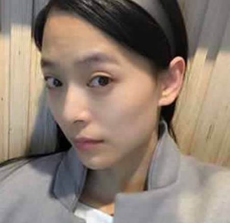 做了超声波去眼袋我真的是美美的707 做了超声波去眼袋我真的是美美的707