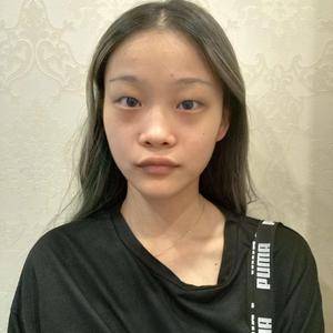 美女超 声 波去眼袋得真实案例! 美女超 声 波去眼袋得真实案例!