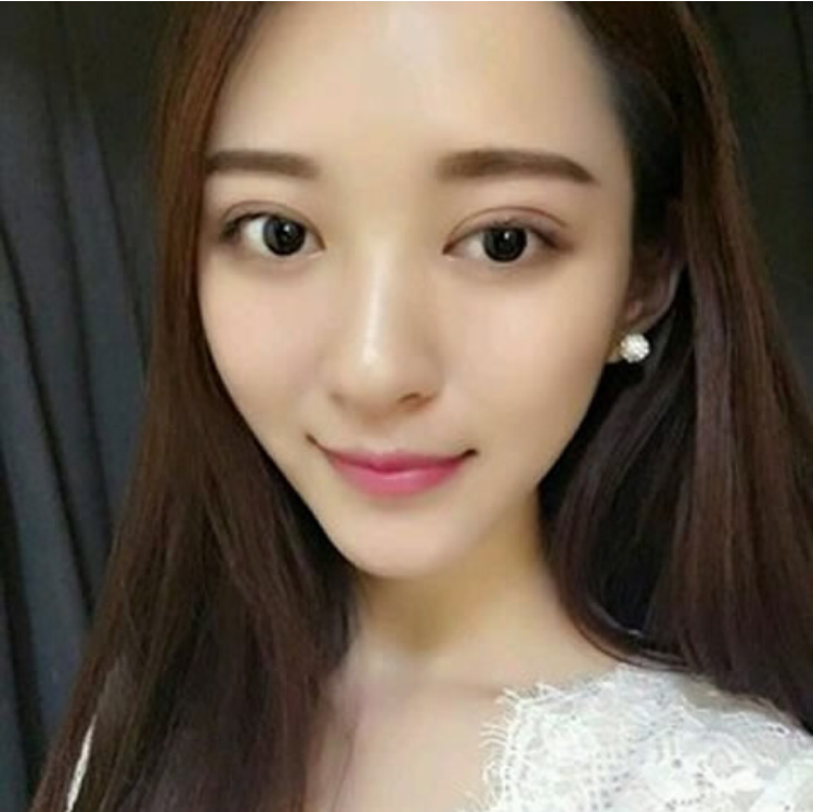 做完超声波双眼皮的我变得如此美丽176 做完超声波双眼皮的我变得如此美丽176