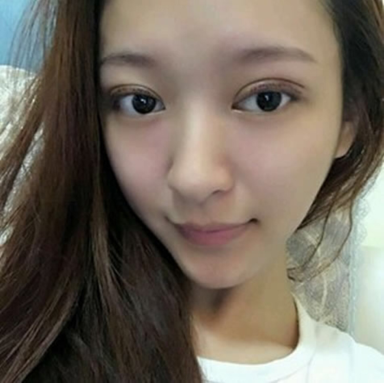 做完超声波双眼皮的我变得如此美丽176 做完超声波双眼皮的我变得如此美丽176