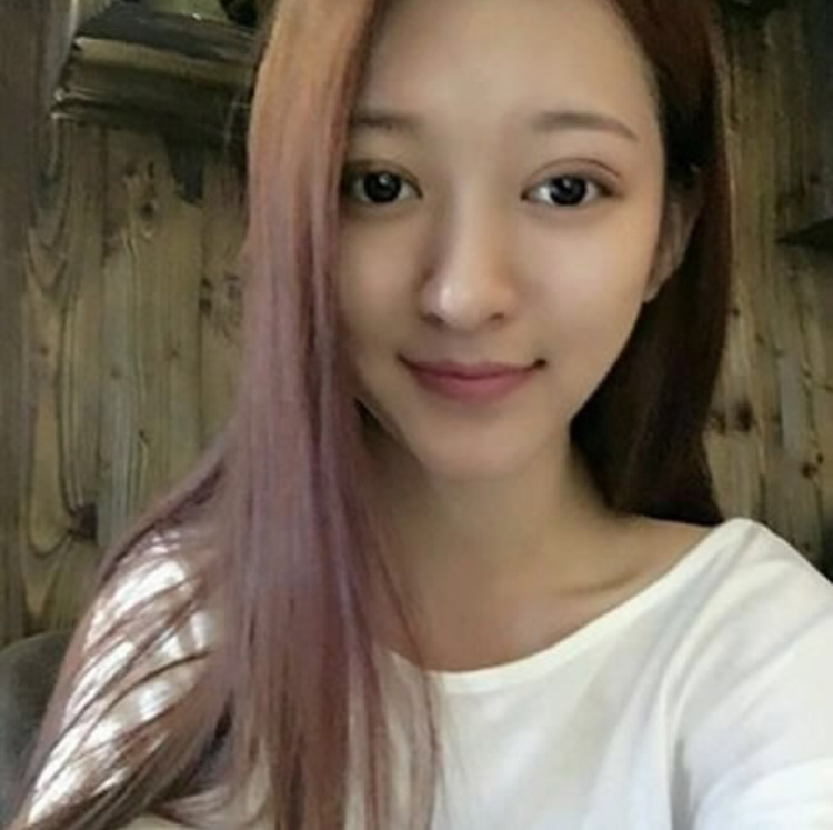 做完超声波双眼皮的我变得如此美丽176 做完超声波双眼皮的我变得如此美丽176