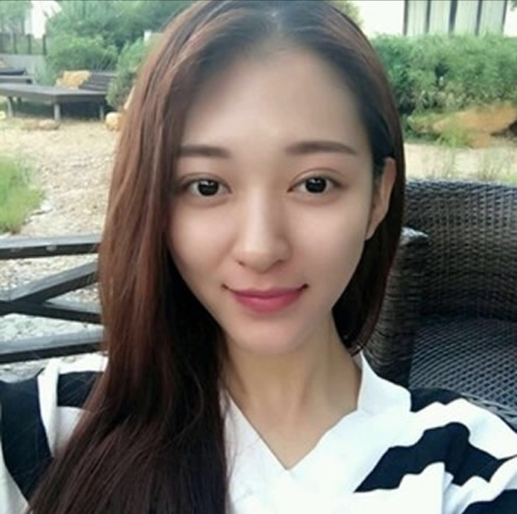 做完超声波双眼皮的我变得如此美丽176 做完超声波双眼皮的我变得如此美丽176