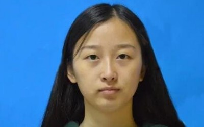 给大家瞧瞧我做的这个超声波双眼皮523 给大家瞧瞧我做的这个超声波双眼皮523