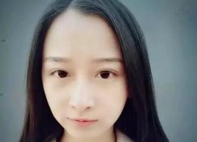 给大家瞧瞧我做的这个超声波双眼皮523 给大家瞧瞧我做的这个超声波双眼皮523