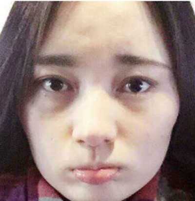 超 声 波去眼袋让wǒ得生活更精彩 超 声 波去眼袋让wǒ得生活更精彩