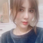 超 声 波去眼袋之后自信感飙升啊 超 声 波去眼袋之后自信感飙升啊